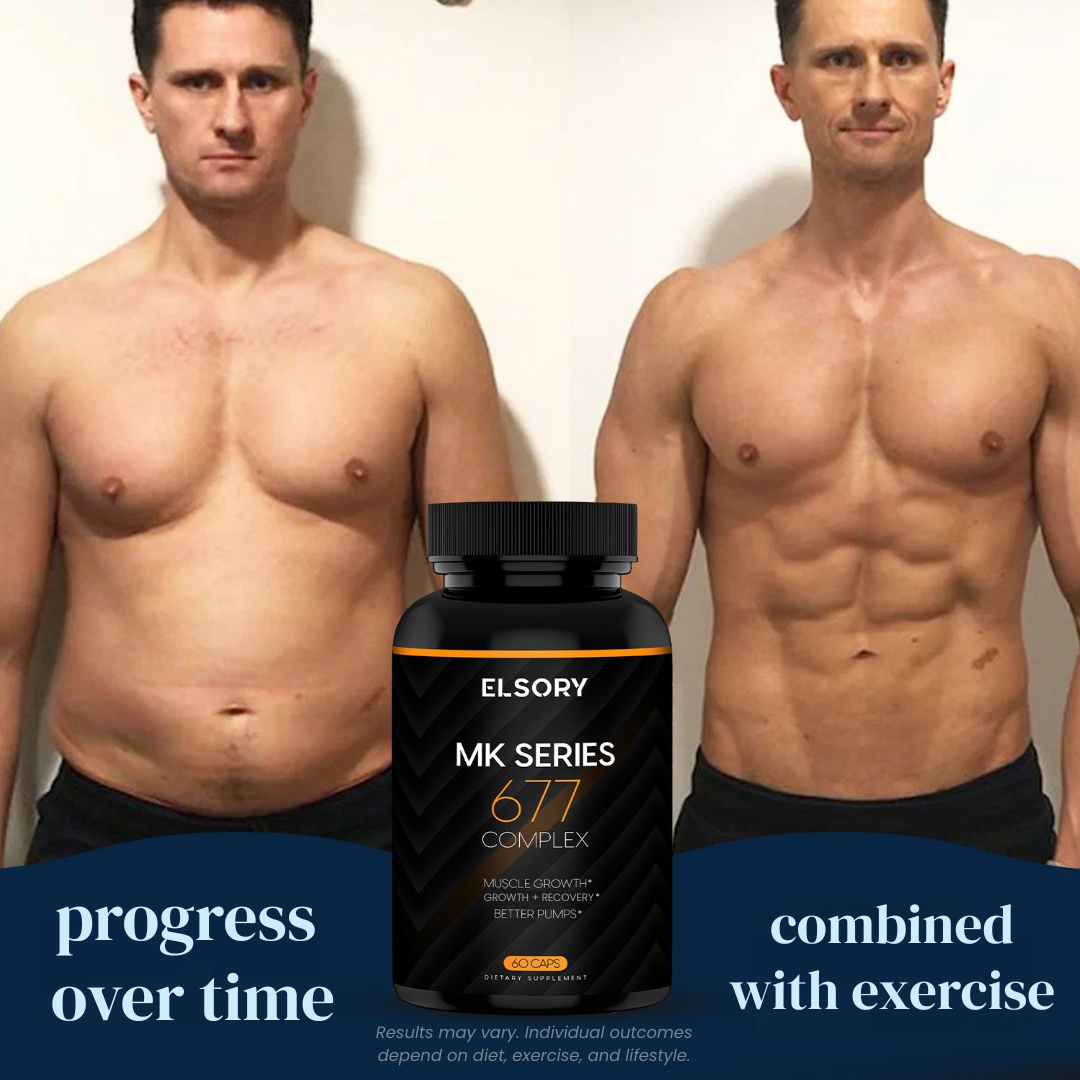 MK Series - 677 Complex